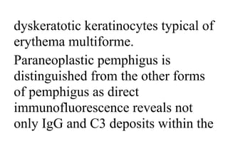 dyskeratotic keratinocytes typical of
erythema multiforme.
Paraneoplastic pemphigus is
distinguished from the other forms
of pemphigus as direct
immunofluorescence reveals not
only IgG and C3 deposits within the
 