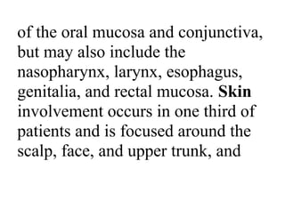 of the oral mucosa and conjunctiva,
but may also include the
nasopharynx, larynx, esophagus,
genitalia, and rectal mucosa. Skin
involvement occurs in one third of
patients and is focused around the
scalp, face, and upper trunk, and
 