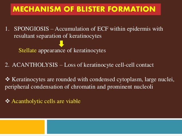 Autoimmune bullous lesions of skin
