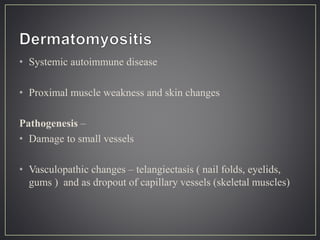 • Systemic autoimmune disease
• Proximal muscle weakness and skin changes
Pathogenesis –
• Damage to small vessels
• Vasculopathic changes – telangiectasis ( nail folds, eyelids,
gums ) and as dropout of capillary vessels (skeletal muscles)
 