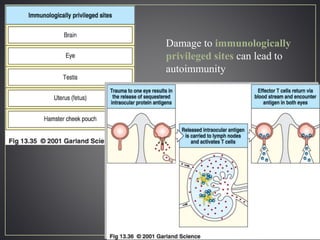 Damage to immunologically
privileged sites can lead to
autoimmunity
 