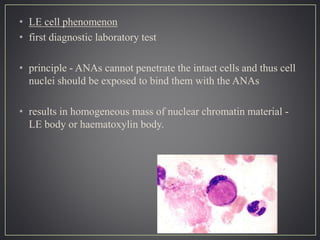 • LE cell phenomenon
• first diagnostic laboratory test
• principle - ANAs cannot penetrate the intact cells and thus cell
nuclei should be exposed to bind them with the ANAs
• results in homogeneous mass of nuclear chromatin material -
LE body or haematoxylin body.
 
