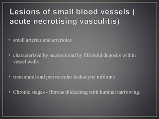• small arteries and arterioles
• characterized by necrosis and by fibrinoid deposits within
vessel walls
• transmural and perivascular leukocytic infiltrate
• Chronic stages - fibrous thickening with luminal narrowing.
 