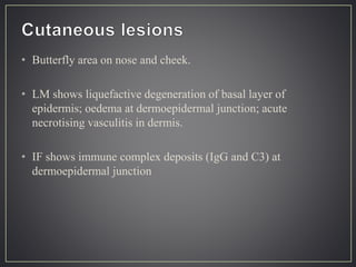 • Butterfly area on nose and cheek.
• LM shows liquefactive degeneration of basal layer of
epidermis; oedema at dermoepidermal junction; acute
necrotising vasculitis in dermis.
• IF shows immune complex deposits (IgG and C3) at
dermoepidermal junction
 