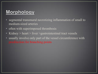 • segmental transmural necrotizing inflammation of small to
medium-sized arteries
• often with superimposed thrombosis
• Kidney > heart > liver >gastrointestinal tract vessels
• usually involve only part of the vessel circumference with
predilection for branching points
 