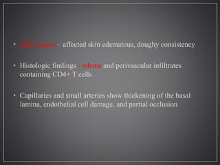 • Early stages – affected skin edematous, doughy consistency
• Histologic findings - edema and perivascular infiltrates
containing CD4+ T cells
• Capillaries and small arteries show thickening of the basal
lamina, endothelial cell damage, and partial occlusion
 