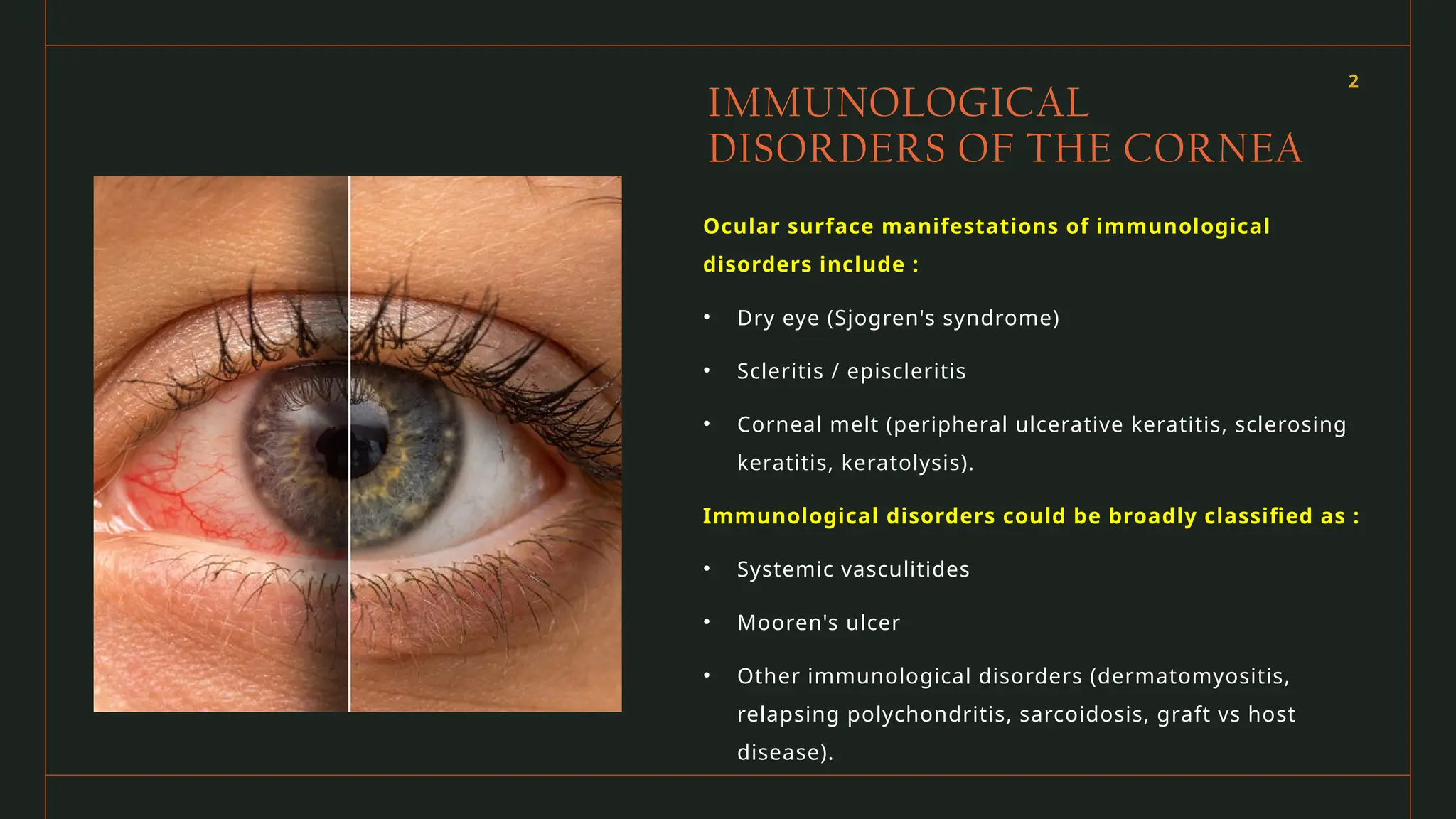 AUTOIMMUNE DISEASE OF EYE.presentation ppt | PPT