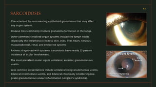 AUTOIMMUNE DISEASE OF EYE.presentation ppt | PPTX
