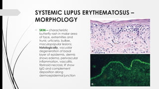AUTOIMMUNE DISEASES - Introduction to it | PPTX