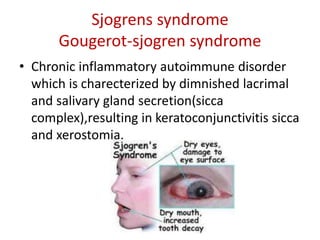 Sjogrens syndrome
Gougerot-sjogren syndrome
• Chronic inflammatory autoimmune disorder
which is charecterized by dimnished lacrimal
and salivary gland secretion(sicca
complex),resulting in keratoconjunctivitis sicca
and xerostomia.
 