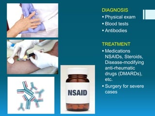 Autoimmune diseases | PPTX