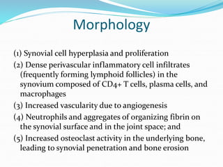 Morphology
(1) Synovial cell hyperplasia and proliferation
(2) Dense perivascular inflammatory cell infiltrates
(frequently forming lymphoid follicles) in the
synovium composed of CD4+ T cells, plasma cells, and
macrophages
(3) Increased vascularity due to angiogenesis
(4) Neutrophils and aggregates of organizing fibrin on
the synovial surface and in the joint space; and
(5) Increased osteoclast activity in the underlying bone,
leading to synovial penetration and bone erosion
 