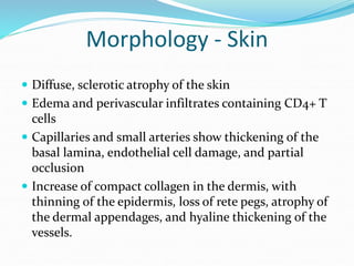 Morphology - Skin
 Diffuse, sclerotic atrophy of the skin
 Edema and perivascular infiltrates containing CD4+ T
cells
 Capillaries and small arteries show thickening of the
basal lamina, endothelial cell damage, and partial
occlusion
 Increase of compact collagen in the dermis, with
thinning of the epidermis, loss of rete pegs, atrophy of
the dermal appendages, and hyaline thickening of the
vessels.
 