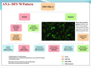 Dense fine speckled
pattern. Mitotic cells
show a fine granular
solid staining. Resting
cells show a very fine,
diffuse speckled stain.
ANA- DFS 70 Pattern
 