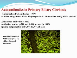 Autoantibodies in Primary Biliary Cirrhosis
Antimitochondrial antibodies ~ 95 %
-Antibodies against oxo-acid dehydrogenase E2 subunits are nearly 100% specific
Antinuclear antibodies ~ 50%
Antibodies against gp210 and Sp100 are nearly 100%
specific but present in only 20% to 30% of cases
Anti-Mitochondrial
Antibodies (M2) on
Kidney/Stomach
Substrate
 