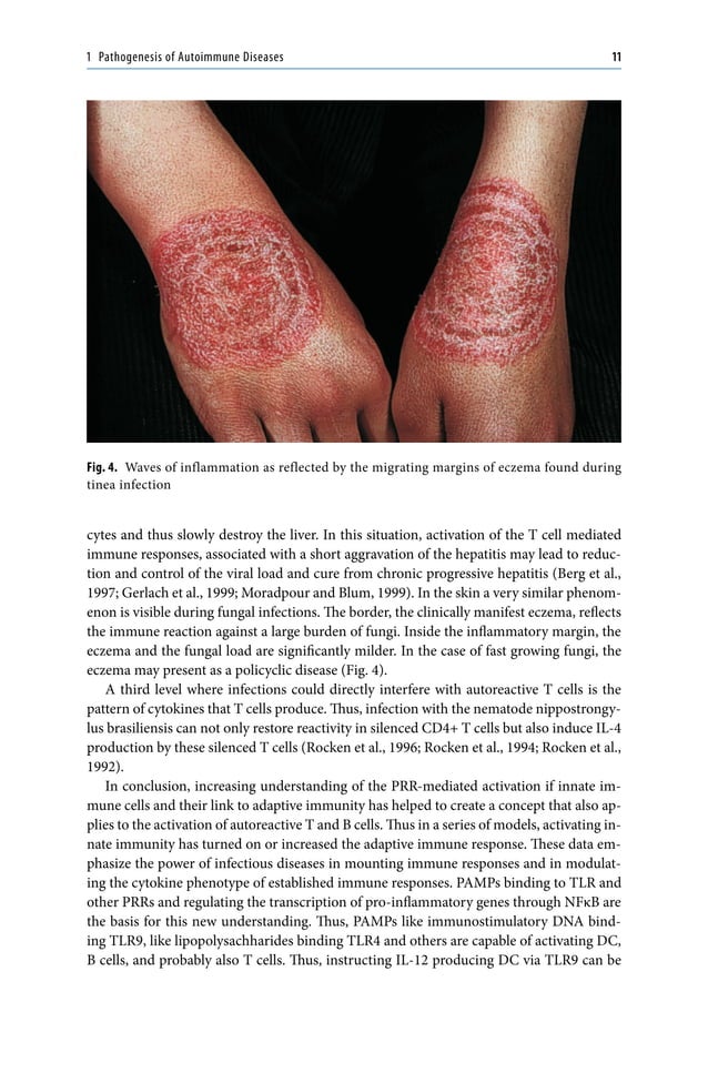 Autoimmune Diseases of the Skin_ Pathogenesis, Diagnosis, Management ...