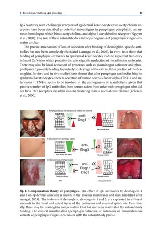 Autoimmune Diseases of the Skin_ Pathogenesis, Diagnosis, Management ...