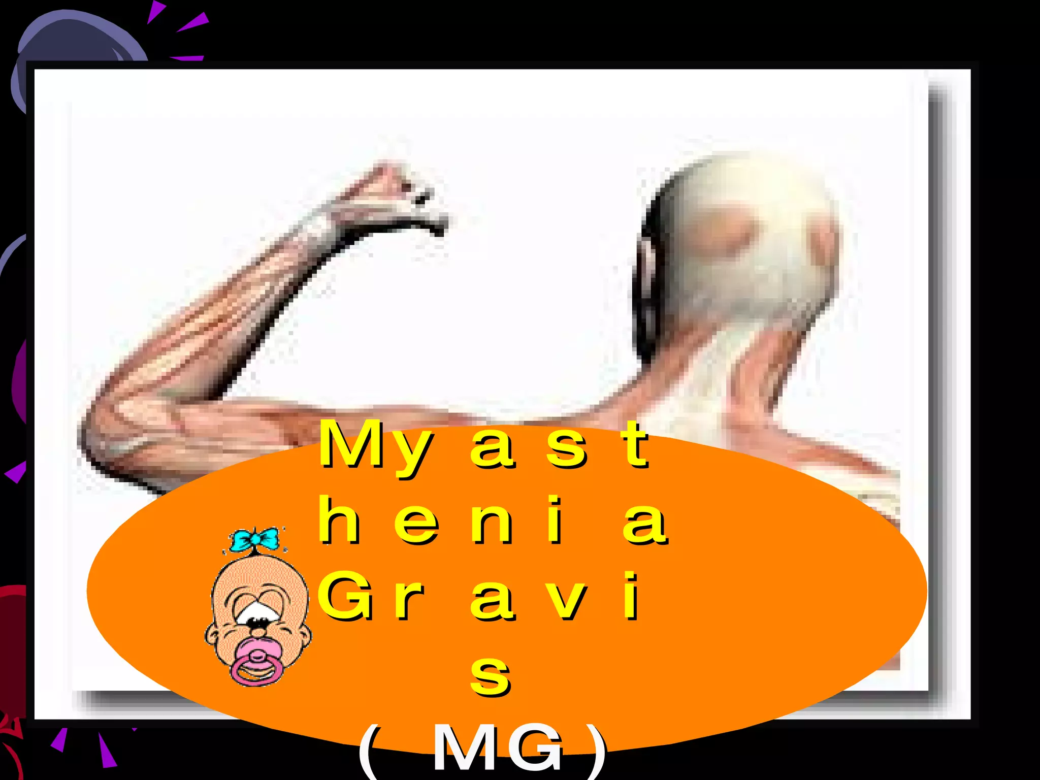 Myasthenia Gravis (MG) 