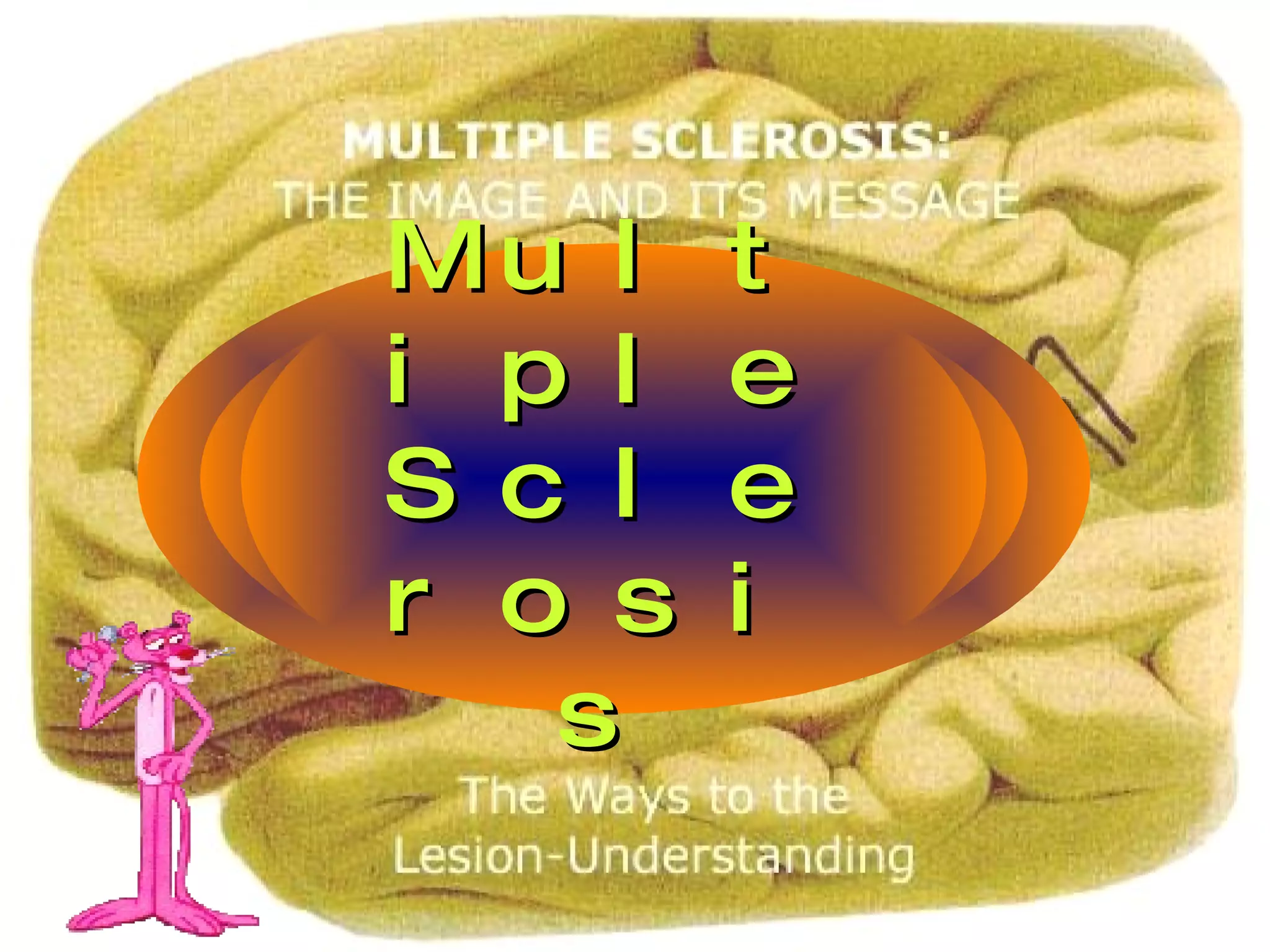 Multiple Sclerosis 