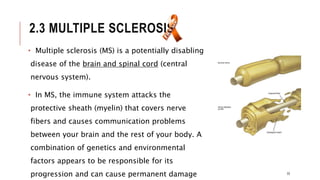 2.3 MULTIPLE SCLEROSIS
• Multiple sclerosis (MS) is a potentially disabling
disease of the brain and spinal cord (central
nervous system).
• In MS, the immune system attacks the
protective sheath (myelin) that covers nerve
fibers and causes communication problems
between your brain and the rest of your body. A
combination of genetics and environmental
factors appears to be responsible for its
progression and can cause permanent damage 33
 