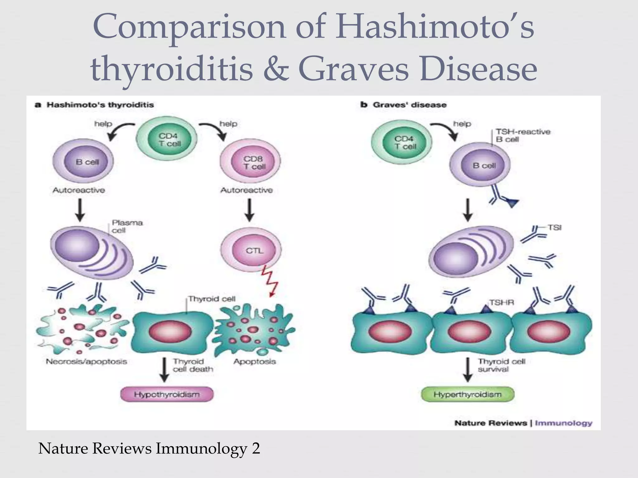 Comparison of Hashimoto’s
thyroiditis & Graves Disease
Nature Reviews Immunology 2
 