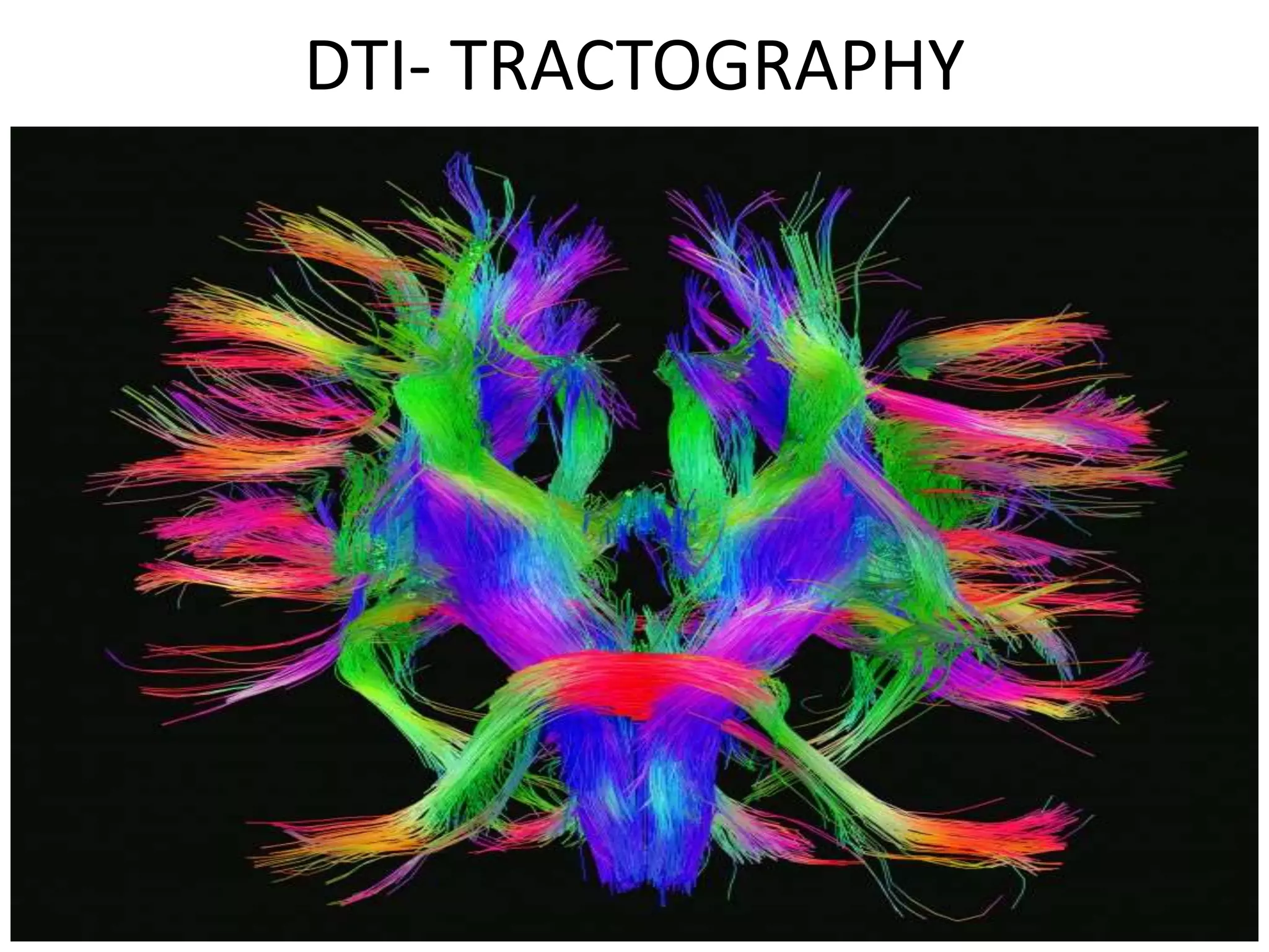 DTI- TRACTOGRAPHY
 