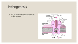 Pathogenesis
• IgG Ab target the Glu N1 subunit of
NMDA receptor
 
