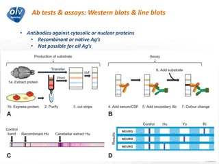 Ab tests & assays: Western blots & line blots
Jo Caekebeke
• Antibodies against cytosolic or nuclear proteins
• Recombinant or native Ag’s
• Not possible for all Ag’s
 