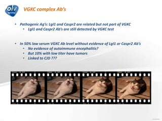VGKC complex Ab’s
Jo Caekebeke
• Pathogenic Ag’s: LgI1 and Caspr2 are related but not part of VGKC
• LgI1 and Caspr2 Ab’s are still detected by VGKC test
• In 50% low serum VGKC Ab level without evidence of LgI1 or Caspr2 Ab’s
• No evidence of autoimmune encephalitis?
• But 10% with low titer have tumors
• Linked to CJD ???
 