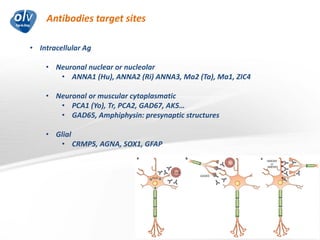 Antibodies target sites
Jo Caekebeke
• Intracellular Ag
• Neuronal nuclear or nucleolar
• ANNA1 (Hu), ANNA2 (Ri) ANNA3, Ma2 (Ta), Ma1, ZIC4
• Neuronal or muscular cytoplasmatic
• PCA1 (Yo), Tr, PCA2, GAD67, AK5…
• GAD65, Amphiphysin: presynaptic structures
• Glial
• CRMP5, AGNA, SOX1, GFAP
 