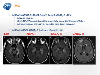 MRI
Jo Caekebeke
• MRI with NMDA-R, AMPA-R, LgI1, Caspr2, GABAB-R Ab’s:
• May be normal
• Or FLAIR/T2 hyperintensities, especially in medial temporal lobes
• Mesiotemporal sclerosis as possible long-term outcome
• MRI with DPPX, GABAA-R Ab’s: less characteristic
LgI1 AMPA-R GABAB-R GABAA-R
 