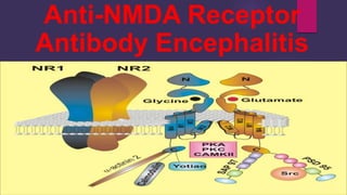 Anti-NMDA Receptor
Antibody Encephalitis
 