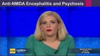 Anti-NMDA Encephalitis and Psychosis
 