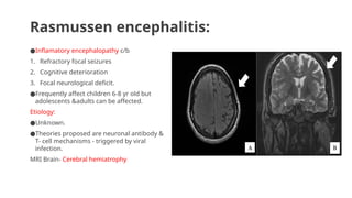 Rasmussen encephalitis:
●Inflamatory encephalopathy c/b
1. Refractory focal seizures
2. Cognitive deterioration
3. Focal neurological deficit.
●Frequently affect children 6-8 yr old but
adolescents &adults can be affected.
Etiology:
●Unknown.
●Theories proposed are neuronal antibody &
T- cell mechanisms - triggered by viral
infection.
MRI Brain- Cerebral hemiatrophy
 