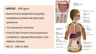 Autoimmune Hepatitis- diagnosis and management | PPTX