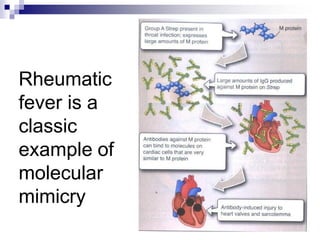 Rheumatic
fever is a
classic
example of
molecular
mimicry
 