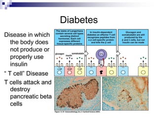 Diabetes
Disease in which
the body does
not produce or
properly use
insulin
“ T cell” Disease
T cells attack and
destroy
pancreatic beta
cells
 