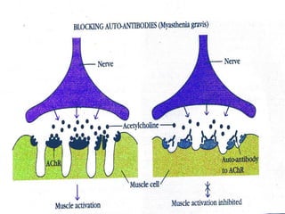 Comprehensive Overview of Autoimmune Diseases: Mechanisms ...