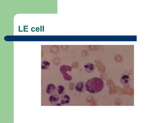Comprehensive Overview of Autoimmune Diseases: Mechanisms ...