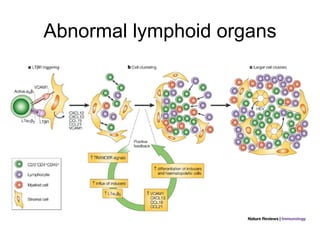 Abnormal lymphoid organs 