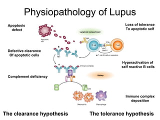 Physiopathology of Lupus Apoptosis  defect Defective clearance Of apoptotic cells Loss of tolerance To apoptotic self Complement deficiency Immune complex deposition Hyperactivation of  self reactive B cells The tolerance hypothesis The clearance hypothesis 