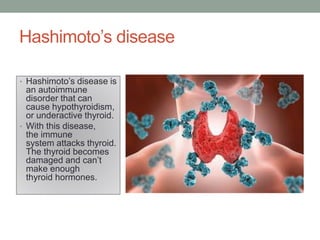 Hashimoto’s disease
• Hashimoto’s disease is
an autoimmune
disorder that can
cause hypothyroidism,
or underactive thyroid.
• With this disease,
the immune
system attacks thyroid.
The thyroid becomes
damaged and can’t
make enough
thyroid hormones.
 