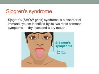 Sjogren's syndrome
• Sjogren's (SHOW-grins) syndrome is a disorder of
immune system identified by its two most common
symptoms — dry eyes and a dry mouth.
 