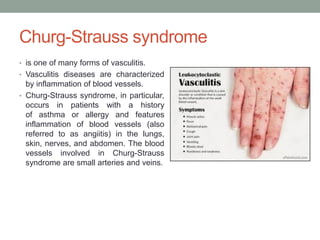 Churg-Strauss syndrome
• is one of many forms of vasculitis.
• Vasculitis diseases are characterized
by inflammation of blood vessels.
• Churg-Strauss syndrome, in particular,
occurs in patients with a history
of asthma or allergy and features
inflammation of blood vessels (also
referred to as angiitis) in the lungs,
skin, nerves, and abdomen. The blood
vessels involved in Churg-Strauss
syndrome are small arteries and veins.
 