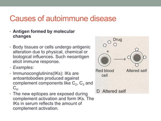 Causes of autoimmune disease
• Antigen formed by molecular
changes
• Body tissues or cells undergo antigenic
alteration due to physical, chemical or
biological influences. Such neoantigen
elicit immune response.
• Examples:
• Immunoconglutinins(IKs): IKs are
antoantobodies produced against
complement components like C2, C3 and
C4.
• The new epitopes are exposed during
complement activation and form IKs. The
IKs in serum reflects the amount of
complement activation.
 