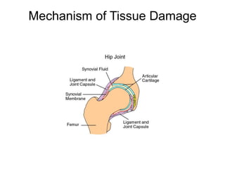 Mechanism of Tissue Damage
 