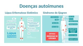 Doenças autoimunes
Lúpus Eritematoso Sistêmico Síndrome de Sjogren
 