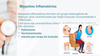 Miopatias Inflamatórias
Miopatias inflamatórias formam um grupo heterogêneo de
doenças raras caracterizadas por lesão muscular imunomediada e
inflamação.
Com base nas características clínicas, morfológicas e imunológicas,
três distúrbio:
 Polimiosite
 Dermatomiosite
 miosite por corpo de inclusão
 
