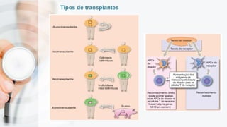 Tipos de transplantes
 