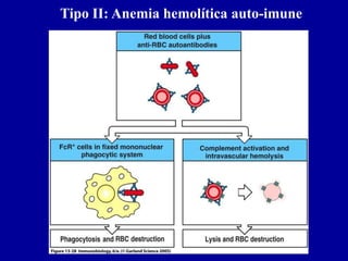 Tipo II: Anemia hemolítica auto-imune

Figure 13-28




2001/2002         Prof. Doutor José Cabeda   Imunologia
 